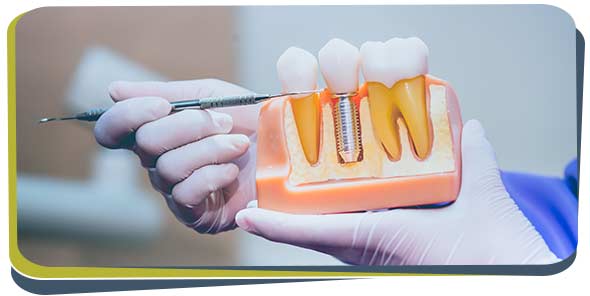 Dental implants near me