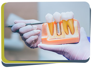 Dental Implants - Prabhdeep K. Gill DDS Near Me in Fresno, CA