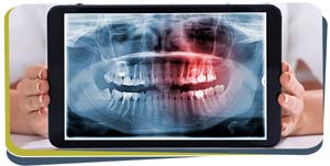 Digital Dental X-Rays Near Me in Fresno, CA