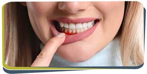 Gum Disease Treatment Specialist Near Me in Fresno CA