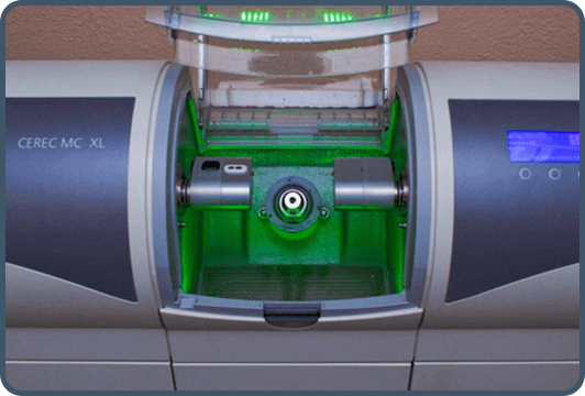 CEREC Machine Specialist Near Me in Fresno, CA CEREC Machine Specialist Near Me in Fresno, CA