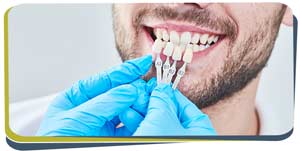 Dental Veneers Specialist Near Me in Fresno CA 