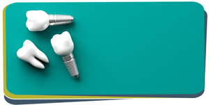 What to Expect from a Dental Implant Procedure? in Fresno, CA? What to Expect from a Dental Implant Procedure? in Fresno, CA?