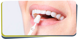 Composite Veneers: A Simple Smile Solution Near Me in Fresno, CA Composite Veneers: A Simple Smile Solution Near Me in Fresno, CA