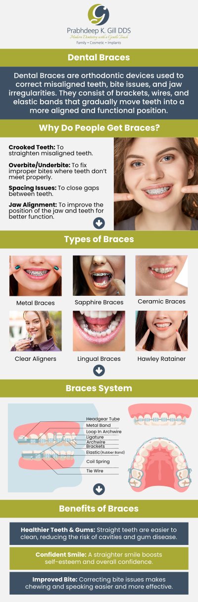 Dr. Prabhdeep K. Gill offers comprehensive braces solutions in Fresno, CA, tailored to meet the unique needs of each patient. Utilizing the latest orthodontic techniques and technologies, she ensures effective and comfortable treatment options for all ages. Whether you're seeking traditional metal braces or discreet clear aligners, Dr. Gill provides personalized care to help you achieve a confident, healthy smile. For more information, contact us or request an appointment online today! We are conveniently located at 7215 N First St Suite 107 Fresno CA 93720. Dr. Prabhdeep K. Gill offers comprehensive braces solutions in Fresno, CA, tailored to meet the unique needs of each patient. Utilizing the latest orthodontic techniques and technologies, she ensures effective and comfortable treatment options for all ages. Whether you're seeking traditional metal braces or discreet clear aligners, Dr. Gill provides personalized care to help you achieve a confident, healthy smile. For more information, contact us or request an appointment online today! We are conveniently located at 7215 N First St Suite 107 Fresno CA 93720.