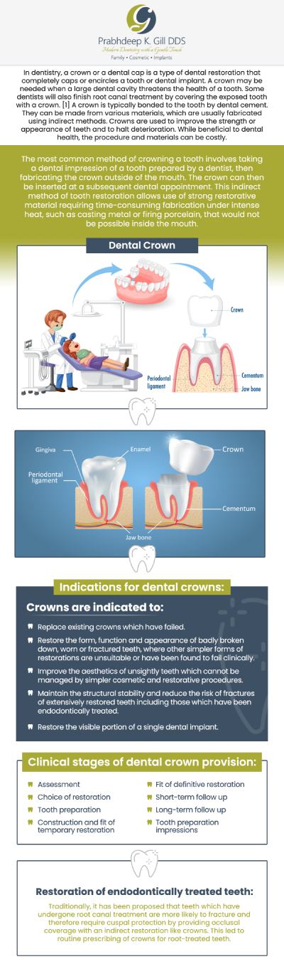 CEREC same-day crowns offer a convenient and efficient solution for dental restorations, eliminating the need for multiple appointments and temporary crowns. Utilizing advanced digital imaging and milling technology, these crowns are custom-designed to fit precisely, ensuring a natural appearance and comfortable fit. Patients can enjoy durable, aesthetically pleasing results in just one visit, enhancing both function and smile confidence. For more information, contact us or request an appointment online today! We are conveniently located at 7215 N First St Suite 107 Fresno CA 93720.