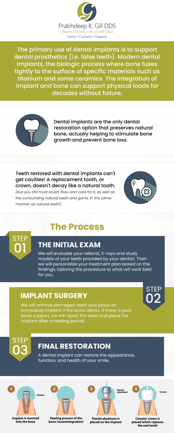 Looking for an experienced implant dentist in Fresno, CA? Dr. Prabhdeep K. Gill offers expert dental implant solutions to restore your smile. Enjoy personalized care and high-quality results for a lasting, natural-looking smile. For more information, contact us or request an appointment online today! We are conveniently located at 7215 N First St Suite 107 Fresno CA 93720. Looking for an experienced implant dentist in Fresno, CA? Dr. Prabhdeep K. Gill offers expert dental implant solutions to restore your smile. Enjoy personalized care and high-quality results for a lasting, natural-looking smile. For more information, contact us or request an appointment online today! We are conveniently located at 7215 N First St Suite 107 Fresno CA 93720.