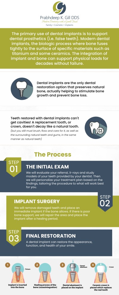 Looking for an experienced implant dentist in Fresno, CA? Dr. Prabhdeep K. Gill offers expert dental implant solutions to restore your smile. Enjoy personalized care and high-quality results for a lasting, natural-looking smile. For more information, contact us or request an appointment online today! We are conveniently located at 7215 N First St Suite 107 Fresno CA 93720. Looking for an experienced implant dentist in Fresno, CA? Dr. Prabhdeep K. Gill offers expert dental implant solutions to restore your smile. Enjoy personalized care and high-quality results for a lasting, natural-looking smile. For more information, contact us or request an appointment online today! We are conveniently located at 7215 N First St Suite 107 Fresno CA 93720.