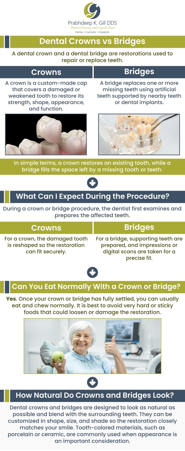 Dental crowns and bridges are essential restorative treatments in Fresno, CA, designed to restore both function and aesthetics. Crowns are ideal for repairing damaged or weakened teeth, while bridges effectively replace missing teeth by spanning the gap with artificial teeth anchored to adjacent natural teeth. Dr. Prabhdeep K. Gill offers personalized solutions to enhance your smile and oral health. For more information, contact us or request an appointment online today! We are conveniently located at 7215 N First St Suite 107 Fresno CA 93720. Dental crowns and bridges are essential restorative treatments in Fresno, CA, designed to restore both function and aesthetics. Crowns are ideal for repairing damaged or weakened teeth, while bridges effectively replace missing teeth by spanning the gap with artificial teeth anchored to adjacent natural teeth. Dr. Prabhdeep K. Gill offers personalized solutions to enhance your smile and oral health. For more information, contact us or request an appointment online today! We are conveniently located at 7215 N First St Suite 107 Fresno CA 93720.