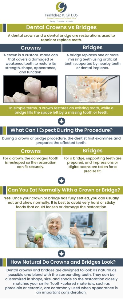 Dental crowns and bridges are essential restorative treatments in Fresno, CA, designed to restore both function and aesthetics. Crowns are ideal for repairing damaged or weakened teeth, while bridges effectively replace missing teeth by spanning the gap with artificial teeth anchored to adjacent natural teeth. Dr. Prabhdeep K. Gill offers personalized solutions to enhance your smile and oral health. For more information, contact us or request an appointment online today! We are conveniently located at 7215 N First St Suite 107 Fresno CA 93720. Dental crowns and bridges are essential restorative treatments in Fresno, CA, designed to restore both function and aesthetics. Crowns are ideal for repairing damaged or weakened teeth, while bridges effectively replace missing teeth by spanning the gap with artificial teeth anchored to adjacent natural teeth. Dr. Prabhdeep K. Gill offers personalized solutions to enhance your smile and oral health. For more information, contact us or request an appointment online today! We are conveniently located at 7215 N First St Suite 107 Fresno CA 93720.