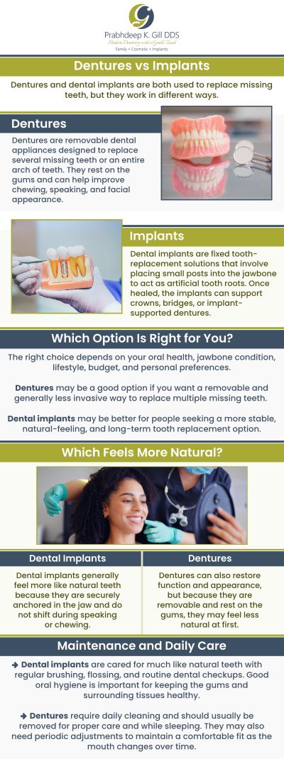 Dentures and dental implants are both excellent options for replacing teeth and restoring smiles, but the optimal solution depends on the individual’s needs. The cost of a single dental implant typically ranges from $2,500 to $3,500, while a full arch implant can range from $10,000 to $20,000 per arch. The cost for denture implants (implant-supported dentures) typically ranges from $3,000 to $4,500 for partial or semi-permanent arches. Both implants and dentures offer unique advantages; however, in many cases, implants may be the preferred option due to their durability and more permanent solution. For more information, contact us or request an appointment online today! We are conveniently located at 7215 N First St Suite 107 Fresno CA 93720.